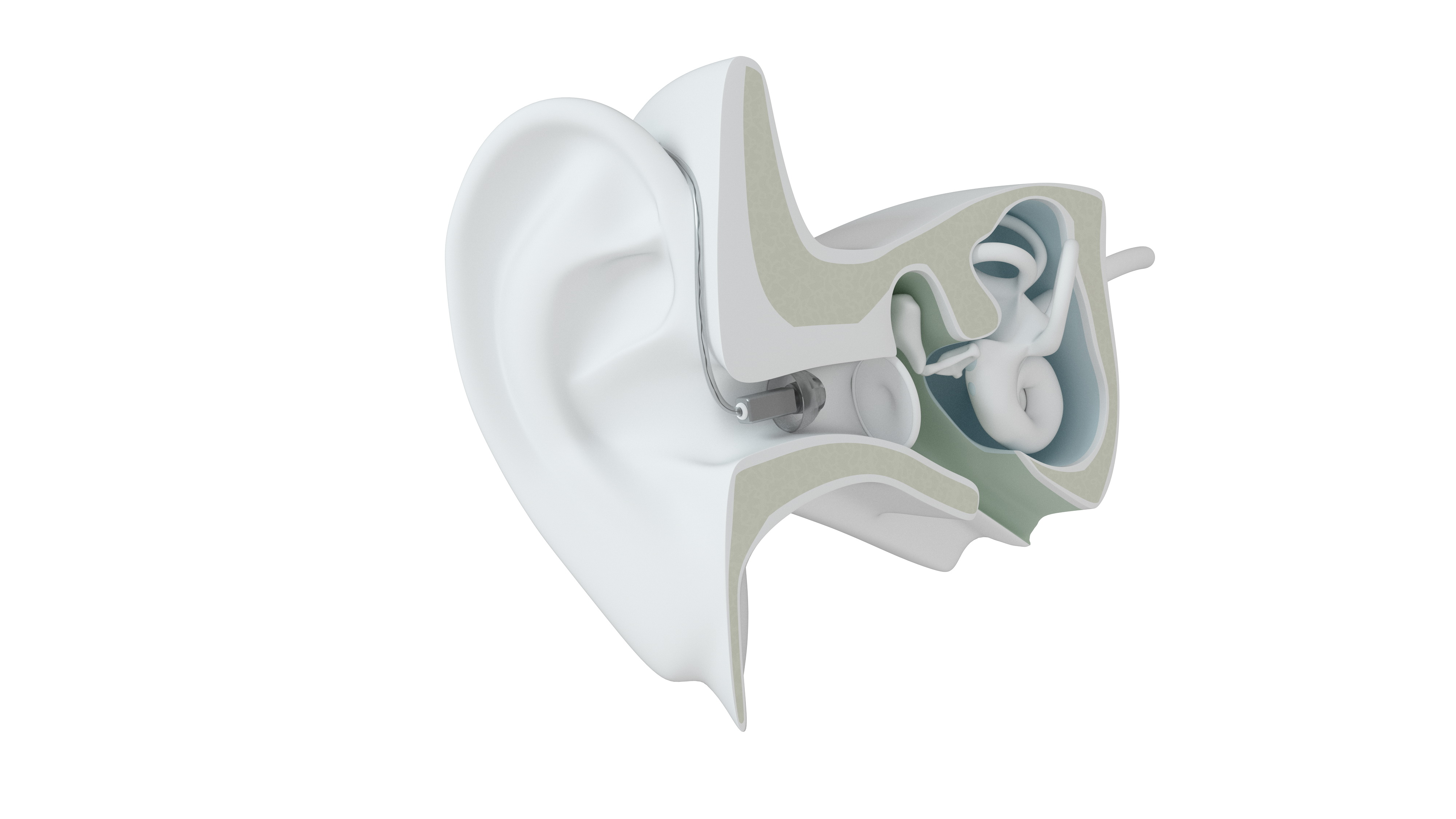 Modelo de Audífono RIE | GN Resound