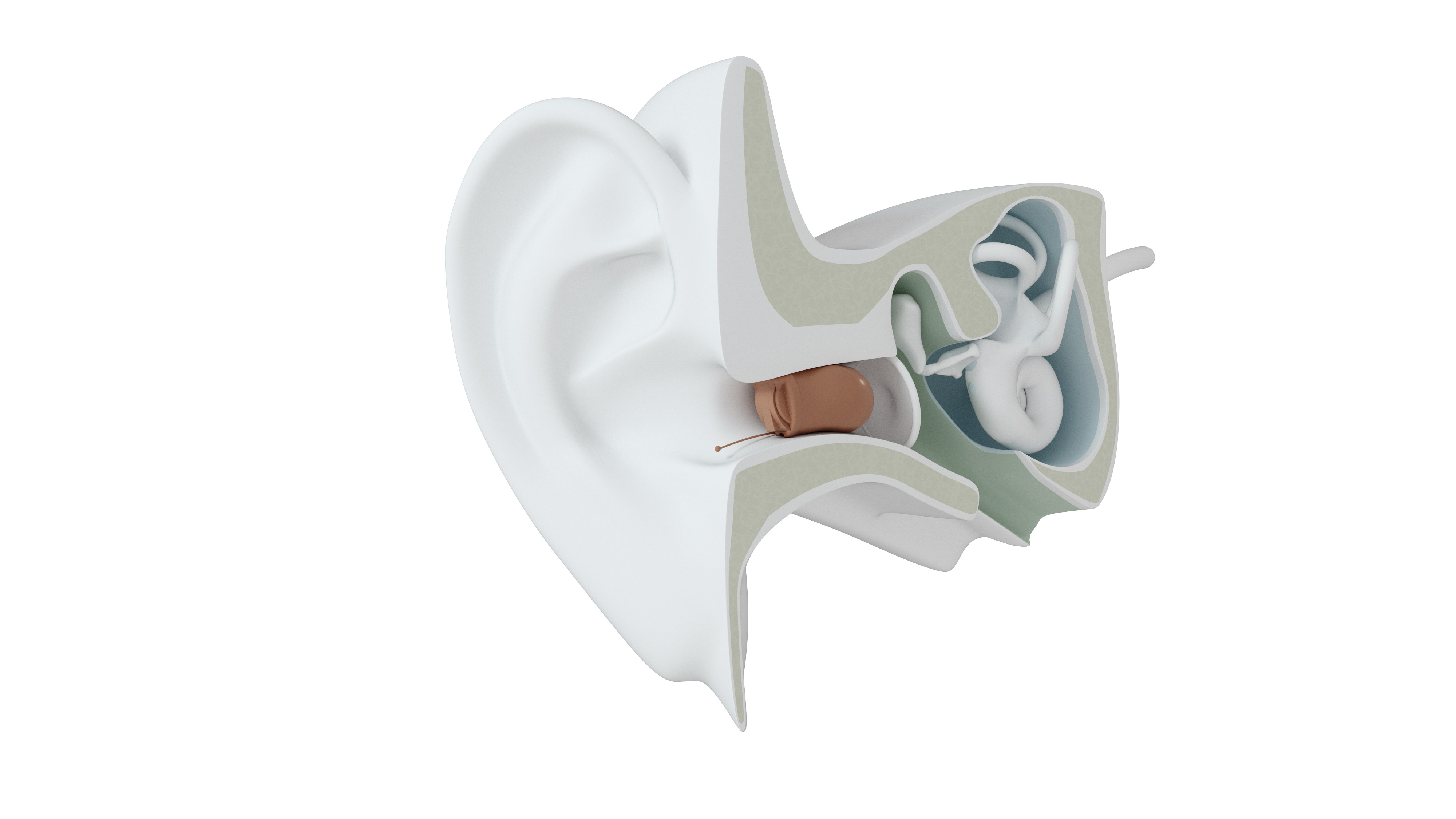 Modelo de Audífono IIC | GN Resound