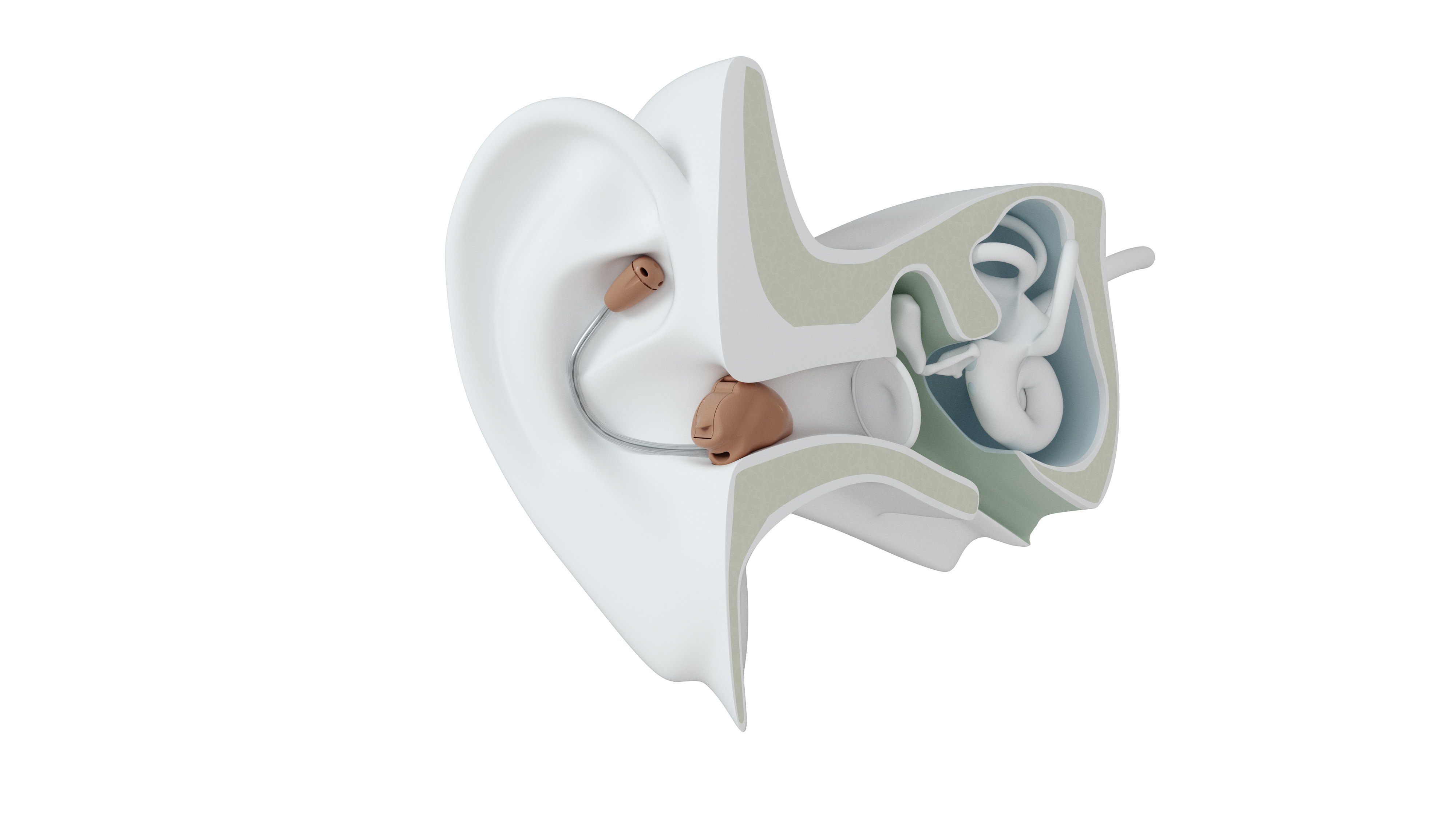 Modelo de Audífono MIH | GN Resound