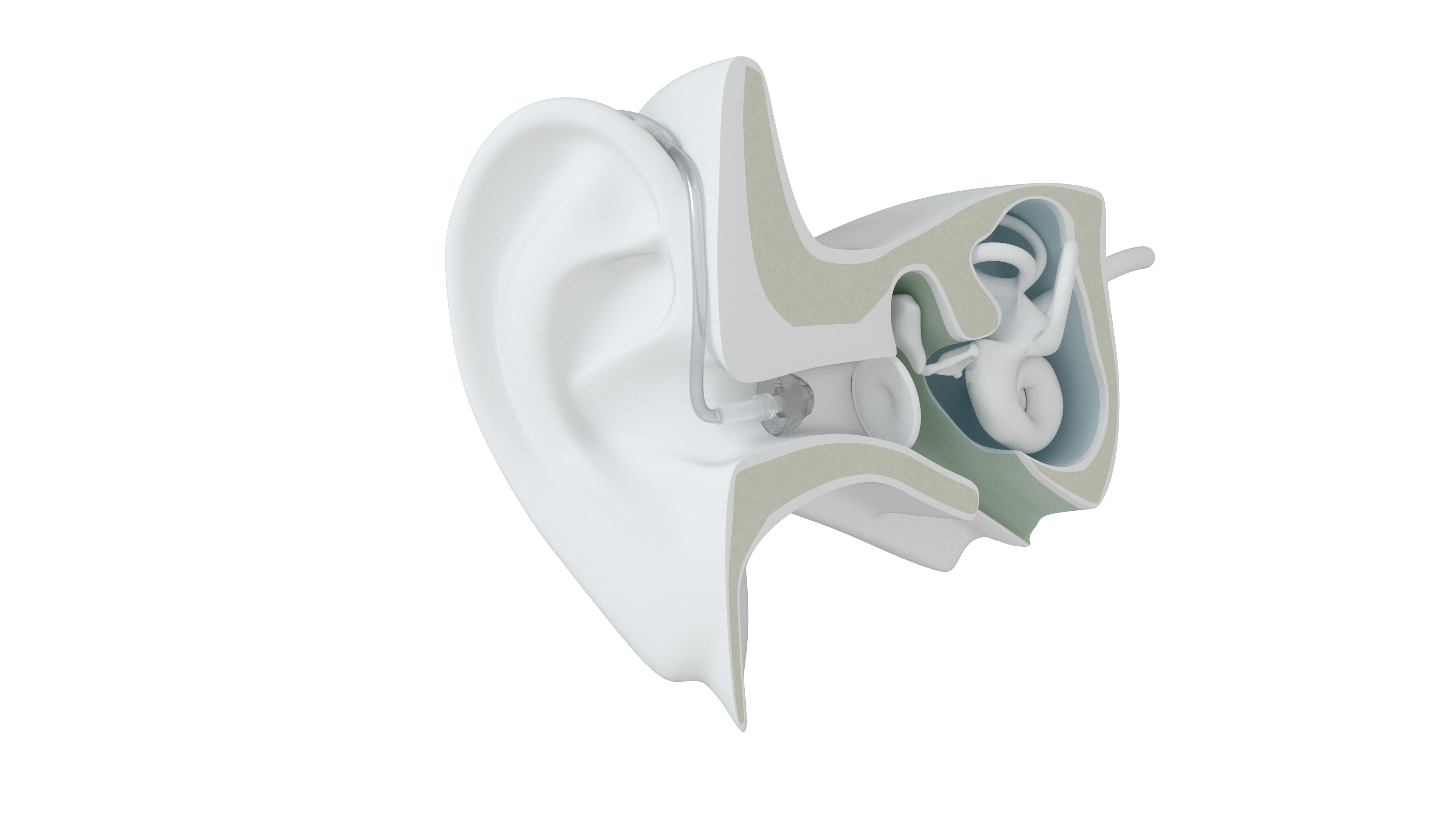 Modelo de Audífono BTE | GN Resound