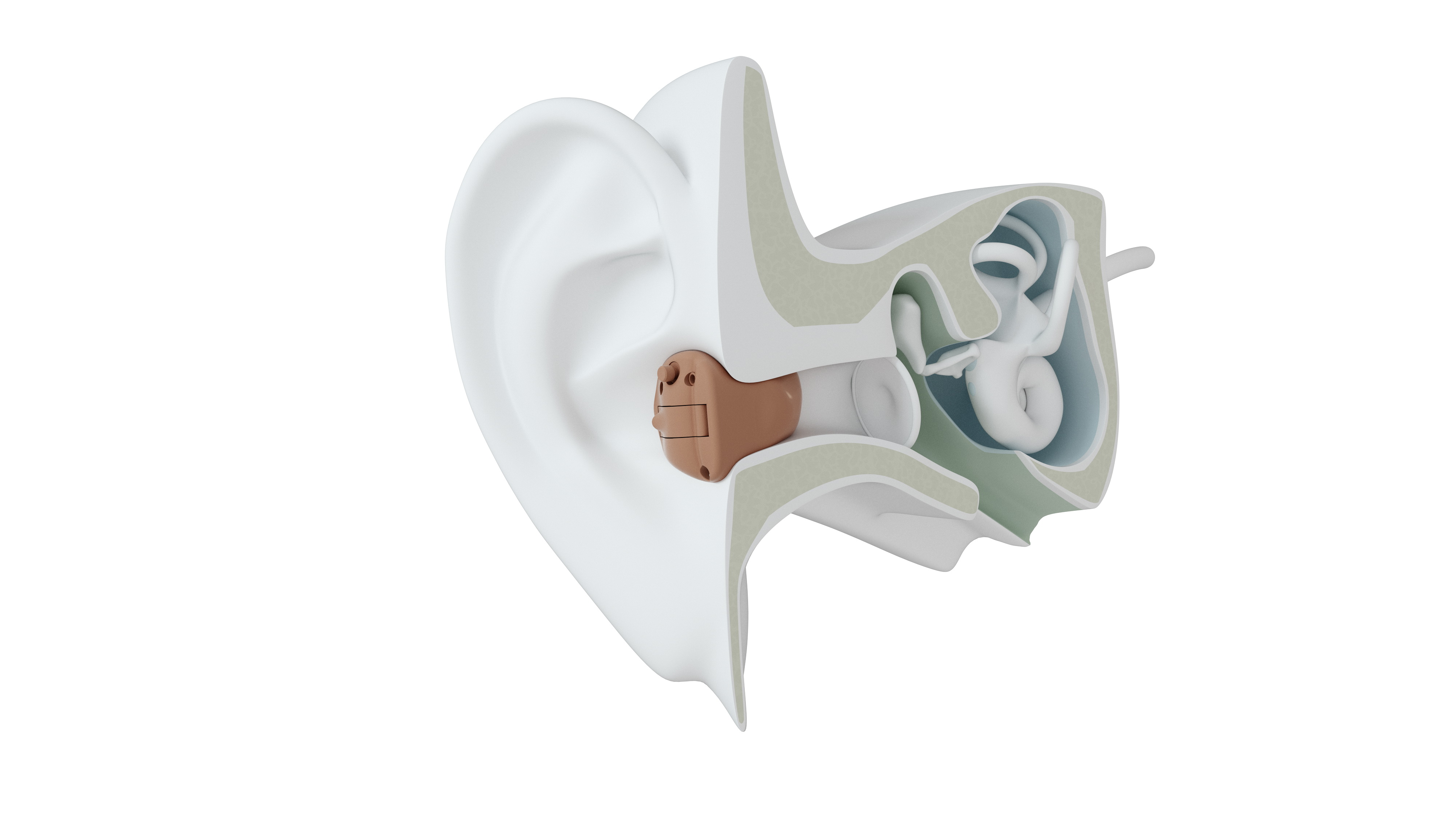 Modelo de Audífono ITC | GN Resound